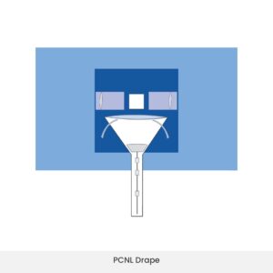 Kidney stone surgery drape with collection pouch in use