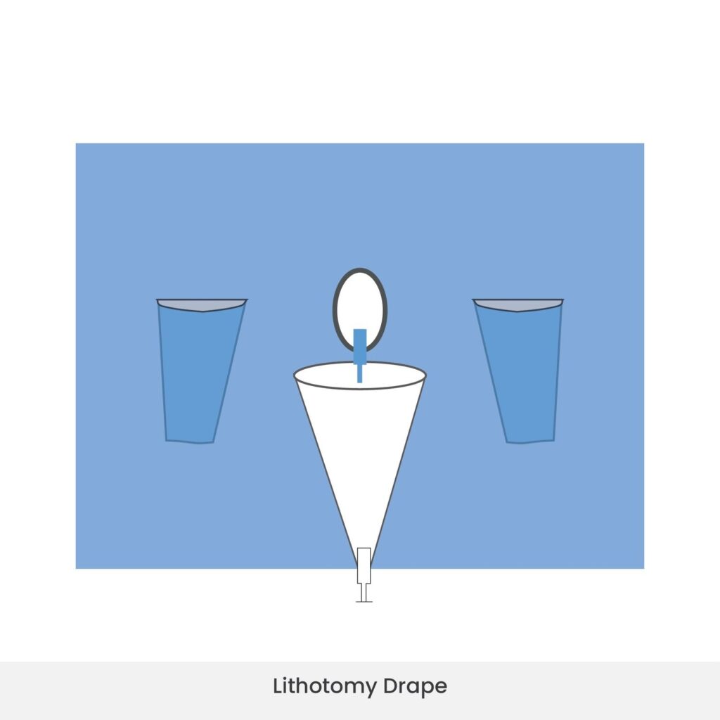 Lithotomy Drape