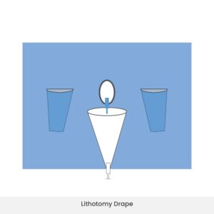 Lithotomy drape with incise and fenestration area