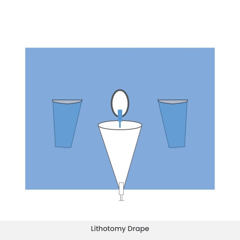 Lithotomy drape with incise and fenestration area