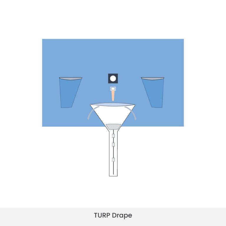 TURP drape placed for transurethral prostate resection